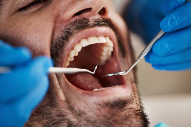 Laser Dentistry in Morris, OK