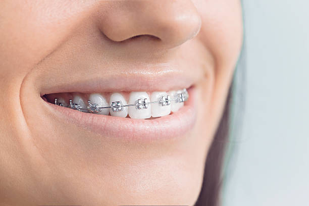 Best Invisalign and Clear Aligners  in Morris, OK